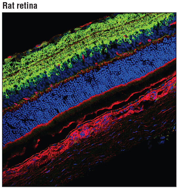 Retina GAD1 Immunofluorecence